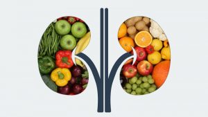 Best Diet Plan For Renal Disorder